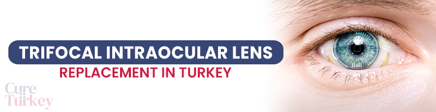 Trifocal Intraocular Lens (Smart Lens)